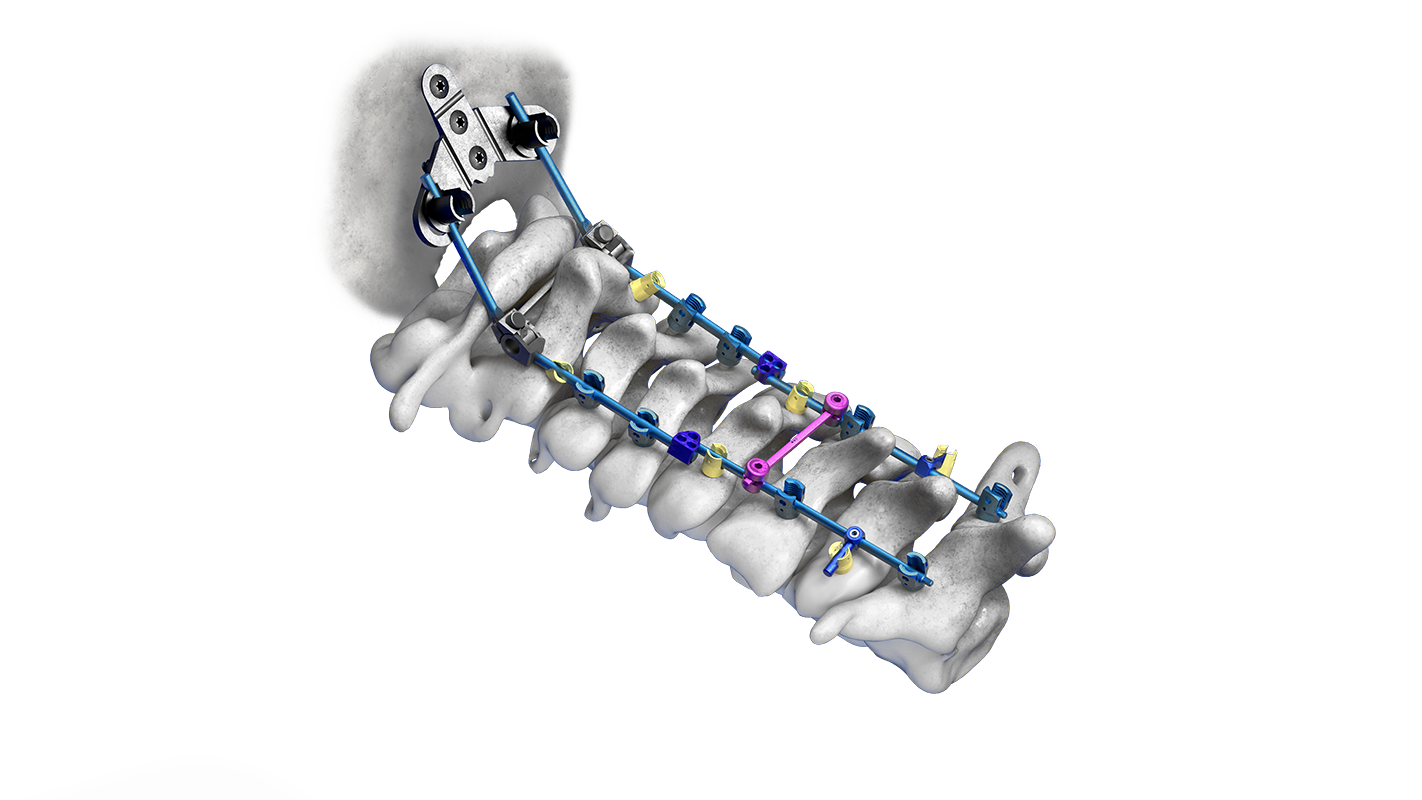 Cervical Spinal System