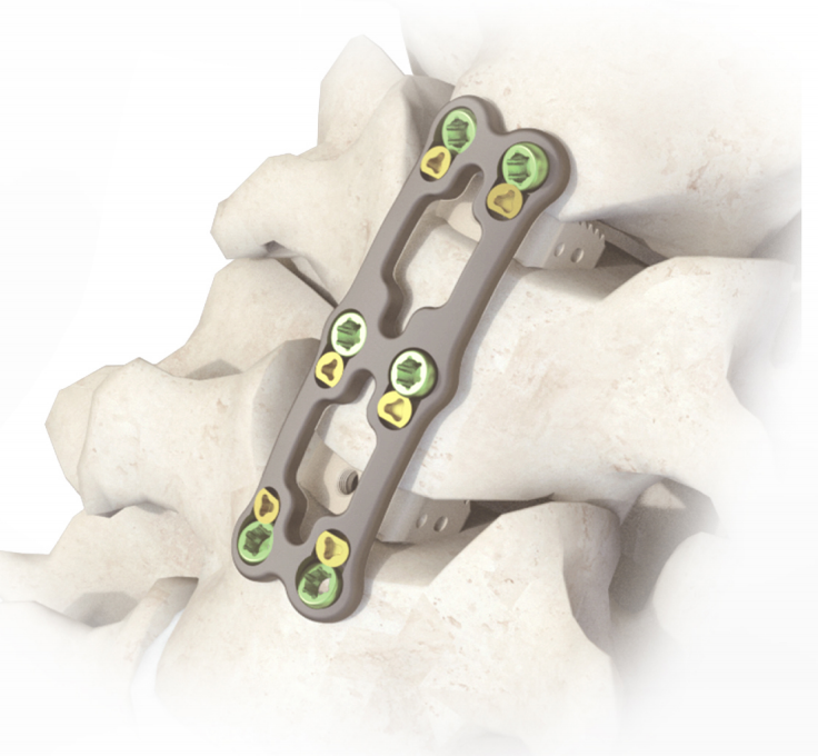 Anterior Cervical Plate Type-II