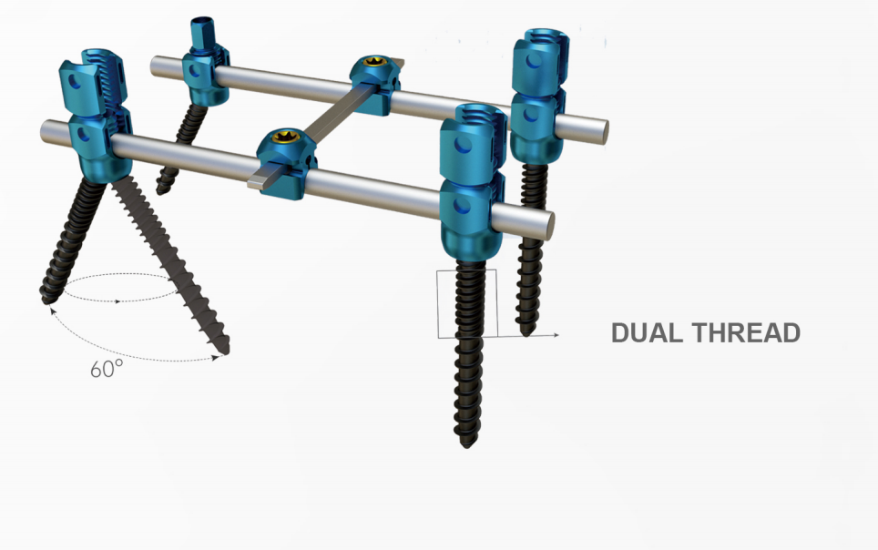 5.5 System Short-Arm Screw ( Poly & Mono)