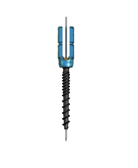 5.5 System Mis Reduction Screw 