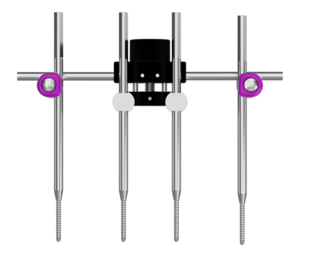 Transverse Bone Transport External Fixator​​