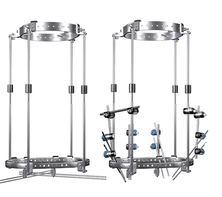 Halo Externanl Fixator Type II