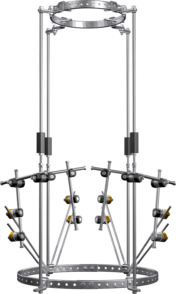 Halo Externanl Fixator Type II